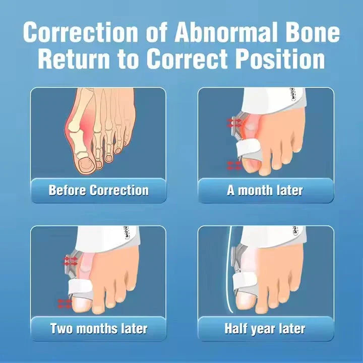 Toe Corrector